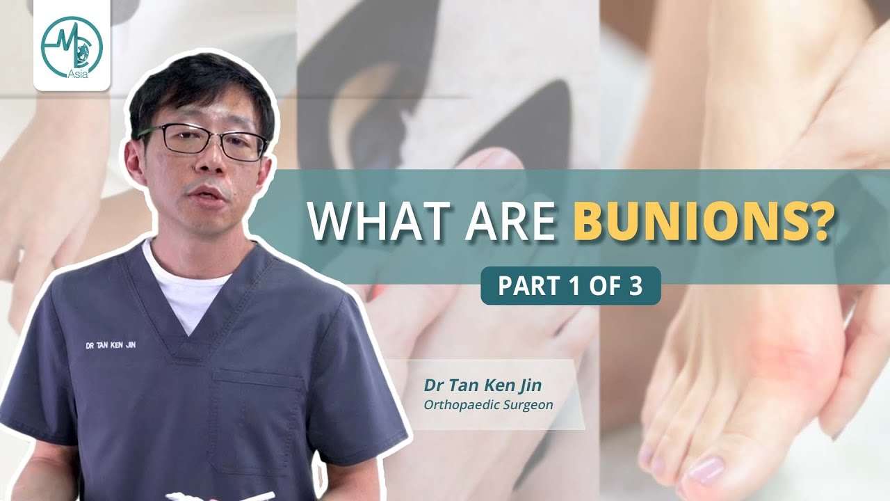 Bunions 1